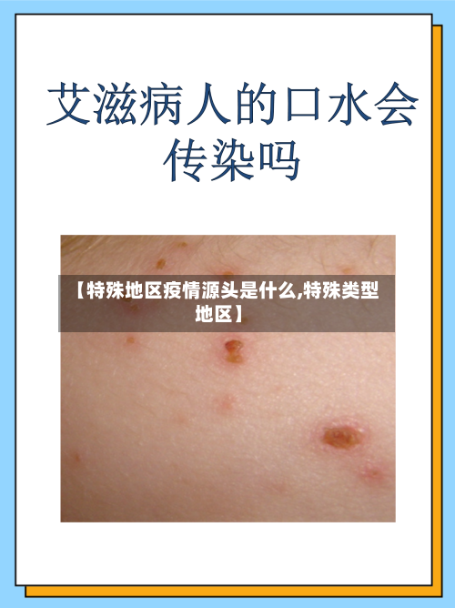 【特殊地区疫情源头是什么,特殊类型地区】
