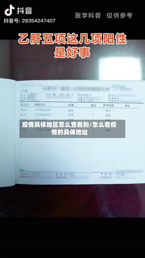 疫情具体地区怎么查看到/怎么看疫情的具体地址